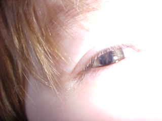 Eye